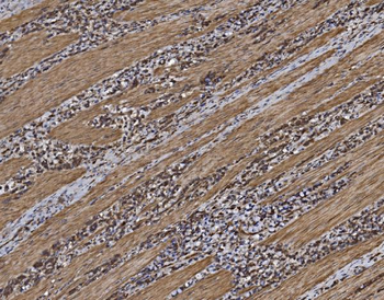 Anti-EIF5 Antibody
