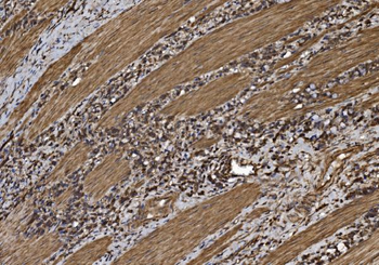 Anti-EIF5 Antibody