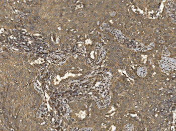 Anti-EIF5 Antibody