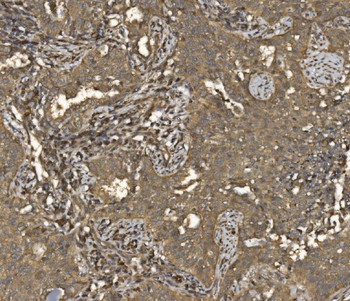 Anti-EIF5 Antibody