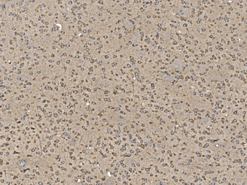 Anti-EIF5 Antibody