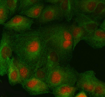 Anti-FAF1 Antibody