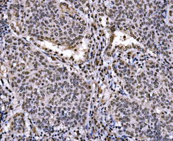 Anti-c-Jun/JUN Antibody