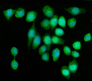 Anti-KIF2A Antibody