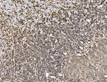 Anti-KIF2A Antibody