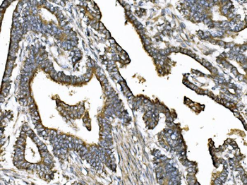 Anti-KIF2A Antibody
