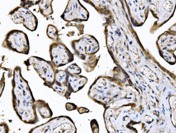Anti-KIF2A Antibody