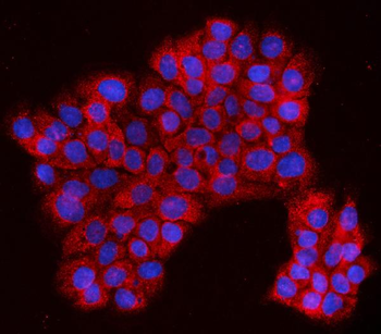 Anti-EVI1/MECOM Antibody