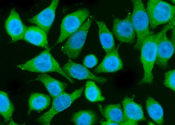 Anti-PI 3 Kinase p85 alpha/PIK3R1 Antibody