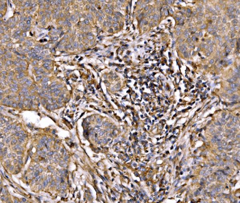 Anti-PI 3 Kinase p85 alpha/PIK3R1 Antibody