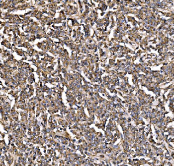 Anti-PI 3 Kinase p85 alpha/PIK3R1 Antibody