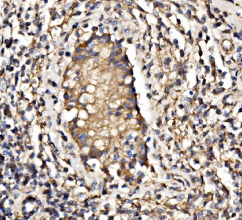 Anti-PI 3 Kinase p85 alpha/PIK3R1 Antibody