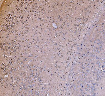 Anti-PI 3 Kinase p85 alpha/PIK3R1 Antibody