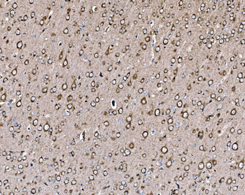 Anti-PI 3 Kinase p85 alpha/PIK3R1 Antibody