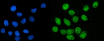 Anti-CoREST/RCOR1 Antibody