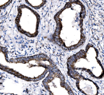 Anti-NKCC1/SLC12A2 Antibody