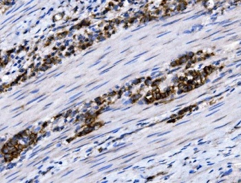 NKCC1/SLC12A2 Antibody