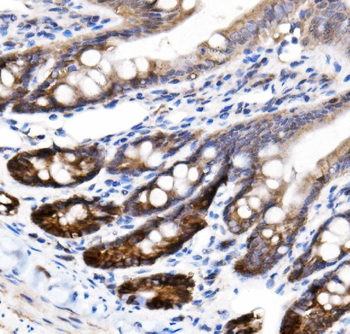 Anti-NKCC1/SLC12A2 Antibody