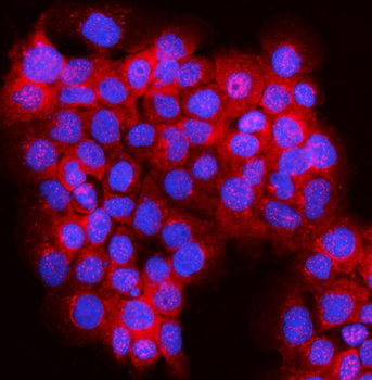 Anti-JLP/SPAG9 Antibody