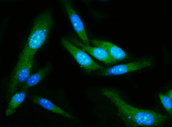 Anti-GSDMD Antibody (monoclonal, 6D11)