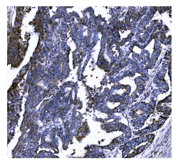 Anti-GSDMD Antibody (monoclonal, 6D11)