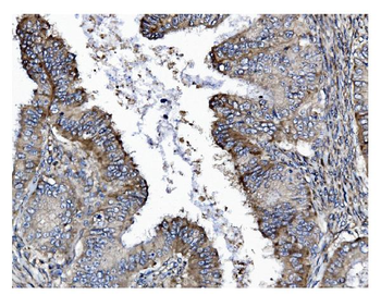 Anti-GSDMD Antibody (monoclonal, 6D11)
