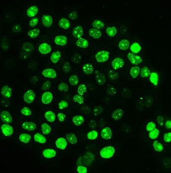 Anti-Ki67 Antibody (monoclonal, 5C7)