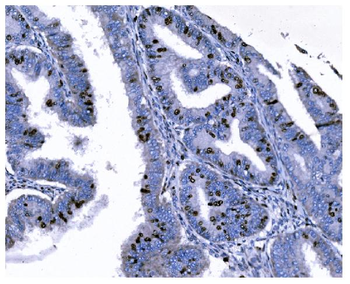 Anti-Ki67 Antibody (monoclonal, 5C7)