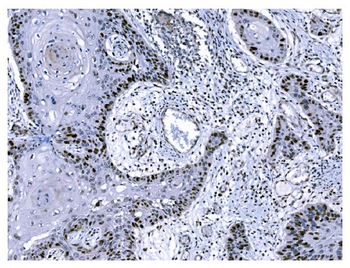 Anti-Ki67 Antibody (monoclonal, 5C7)