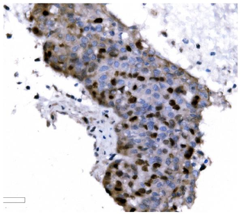 Anti-Ki67 Antibody (monoclonal, 5C7)