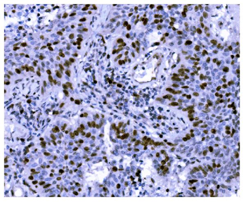 Anti-Ki67 Antibody (monoclonal, 5C7)