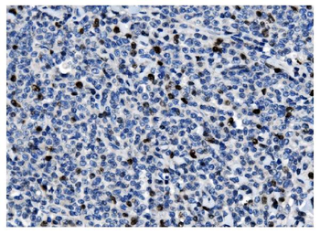 Anti-Ki67 Antibody (monoclonal, 5C7)