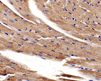 Anti-ACTN2 Antibody