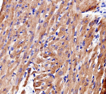 Anti-ACTN2 Antibody