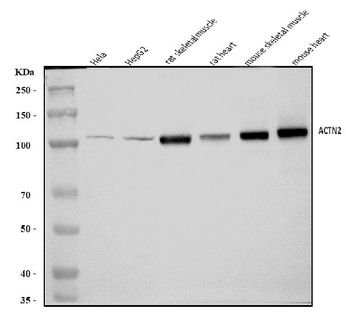 Anti-ACTN2 Antibody