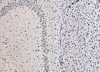 Anti-DBC-1/CCAR2 Antibody