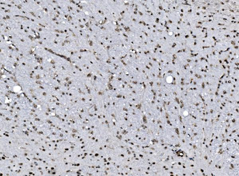 Anti-DBC-1/CCAR2 Antibody