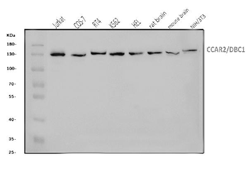 Anti-DBC-1/CCAR2 Antibody