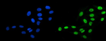 Anti-DBC-1/CCAR2 Antibody