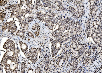 Anti-DBC-1/CCAR2 Antibody