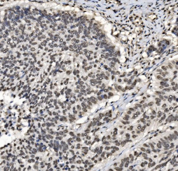 Anti-DBC-1/CCAR2 Antibody