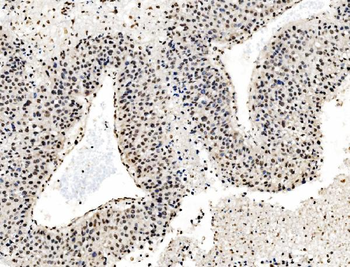 Anti-DBC-1/CCAR2 Antibody