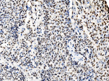 Anti-DBC-1/CCAR2 Antibody