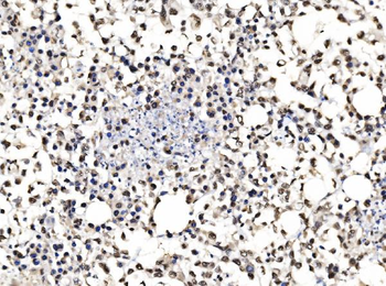 Anti-DBC-1/CCAR2 Antibody
