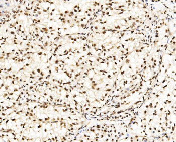 Anti-DBC-1/CCAR2 Antibody