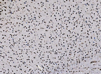 Anti-DBC-1/CCAR2 Antibody