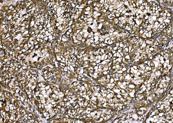Anti-DLAT Antibody