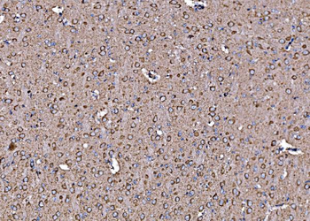 Anti-DLAT Antibody
