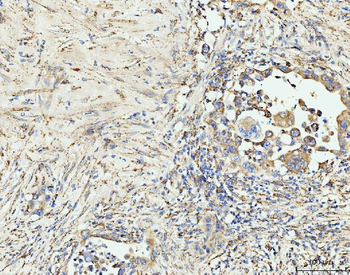 Anti-EDC4 Antibody