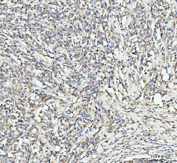 Anti-EDC4 Antibody